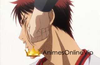 Kuroko no Basket Episódio 13